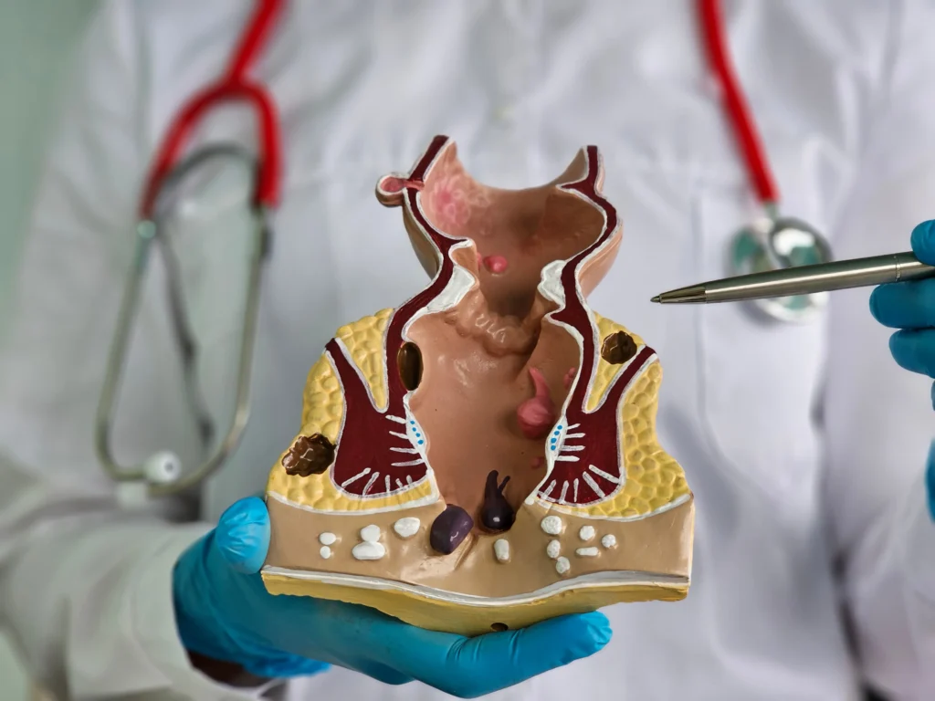 Rectal bleeding and anorectal care