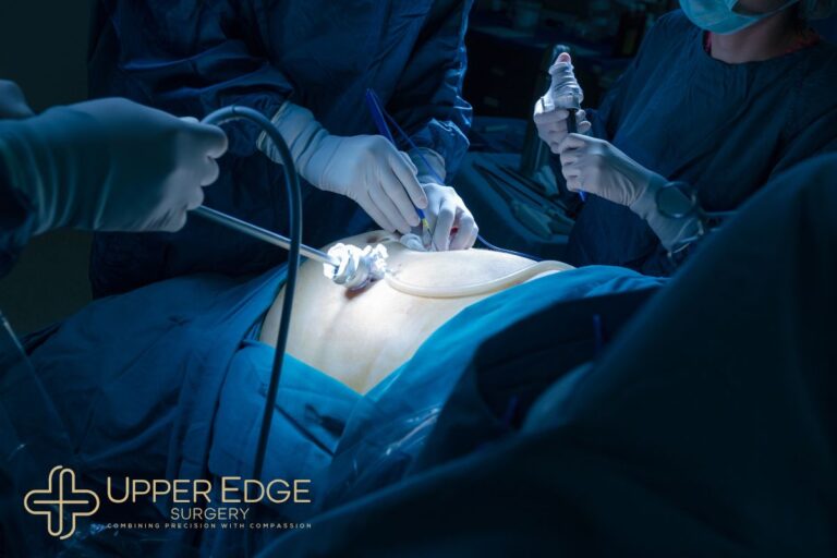 Intraoperative Laparoscopic surgery